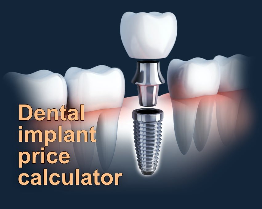 Calculate how much a dental implant costs in Romania 🦷